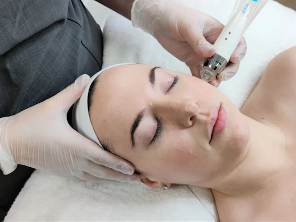 Best Facial for Acne-Prone Skin