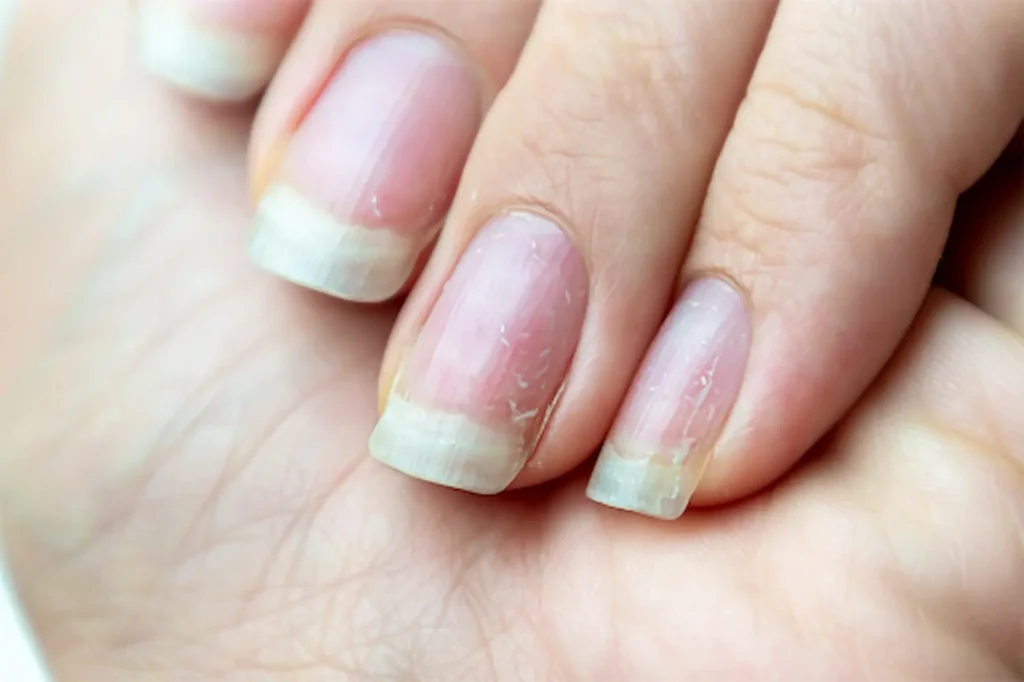 Dubai's Best Nail Care Tips